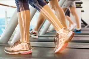 An illustration of a woman's bones in her legs as she walks on a treadmill.