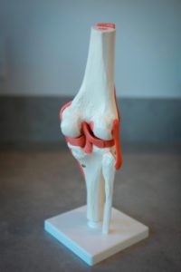 Knee Replacement