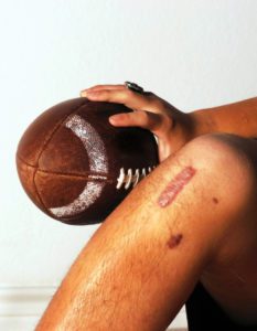 Sports medicine for knee injuries